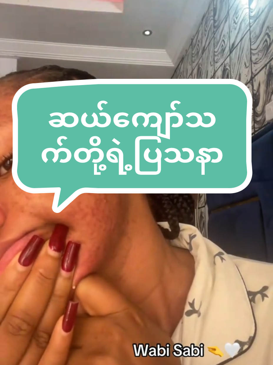 #မင်းကွက်သီးဝက်ခြံပျောက်မျက်နှာသစ် #ဝက်ခြံပျောက်ခြင်သူများတွက် #mimibooမျက်နှာသစ်လေး💚💚 #မှာယူချင်ပါကvb09989195092ကိုဆက်သွယ်ဝယ်ယူနိုင်ပါတယ်ရှင့် 