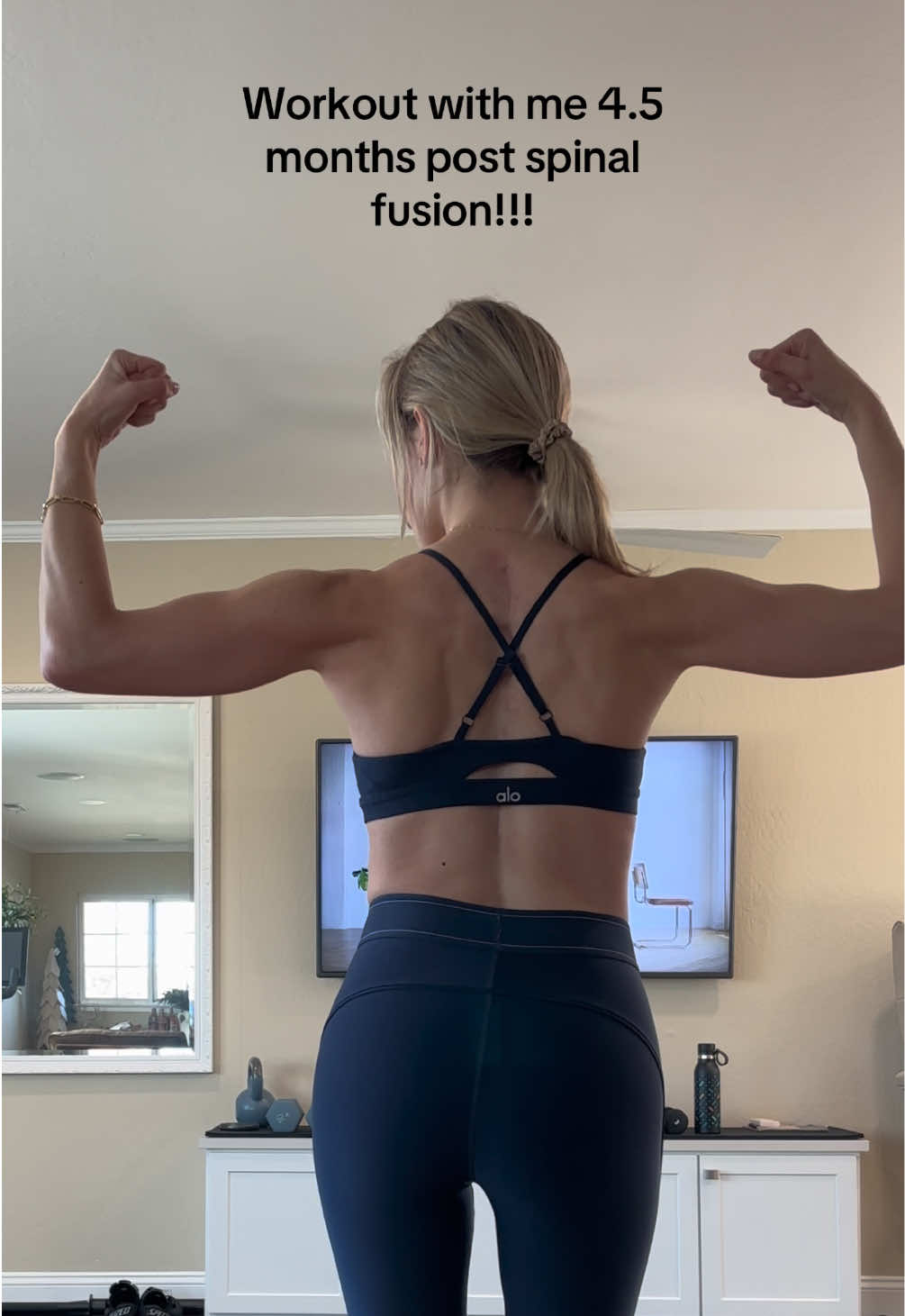Love documenting my progress 🙌 Working out with @gracefreyrefit and @FORM for you has been amazing in my recovery!!❤️‍🩹 #scoliosis #scoliosissurgery #surgeryrecovery #fyp #Fitness