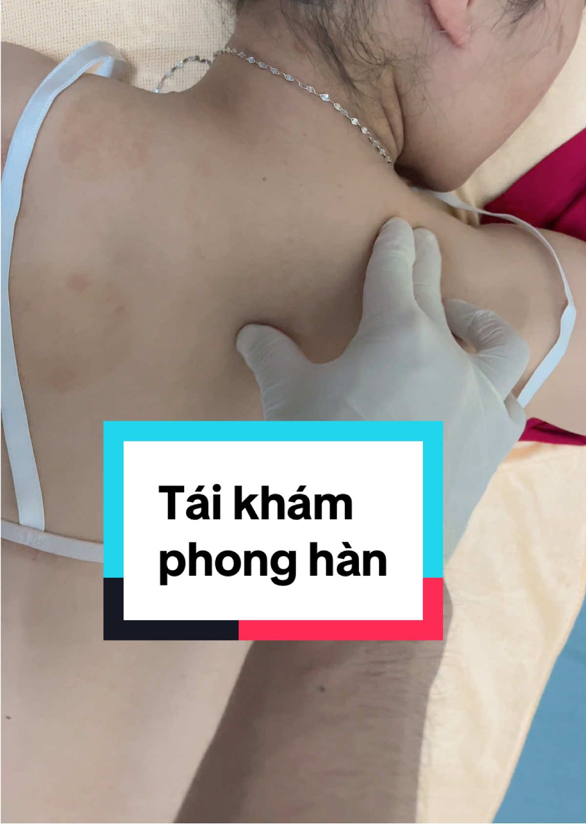 tái khám - sau 1 lần trị liệu nhiễm phong hàn, đã thuyên giảm! #phonghàn 