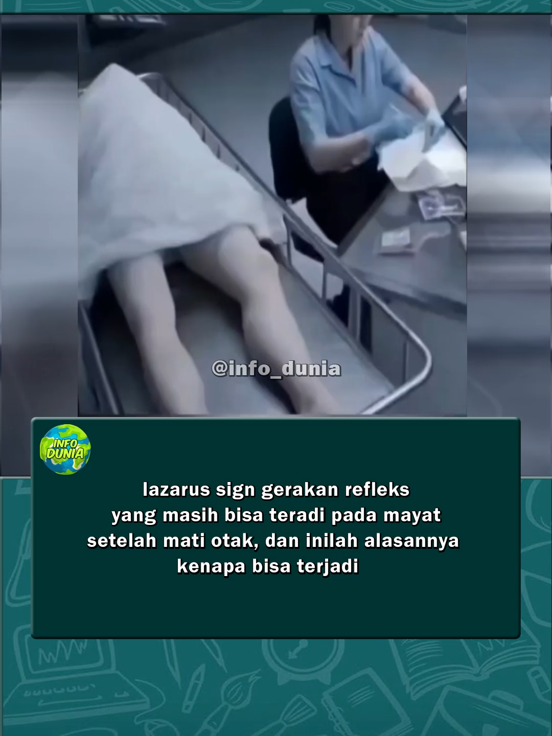 Lazarus sign adalah refleks tubuh yg bisa muncul pada pasien yang sudah dinyatakan mati otak. Dalam kondisi mati otak, seluruh fungsi otak sudah berhenti total sehingga tdk ada kesadaran, tdk ada aktivitas berpikir, dan tidak ada kemungkinan pulih. Namun, sumsum tulang belakang masih bisa menyimpan sedikit aktivitas listrik. Aktivitas inilah yang membuat beberapa bagian tubuh mampu bergerak sendiri tanpa kendali dan tanpa keterlibatan otak. Gerakannya terlihat jelas dan kadang membuat orang terkejut. Lengan bisa terangkat perlahan, tangan bisa menekuk lalu bergerak ke dada atau wajah, dan tubuh bagian atas bisa terangkat sedikit seperti melakukan sit-up lambat. Semua ini bukan tanda orang hidup kembali, melainkan respons otomatis dari saraf di tulang belakang. Fenomena ini jarang, tetapi sudah lama dikenal dalam dunia medis dan sering disalahpahami oleh keluarga pasien karena tampak seperti momen “bangkit”. . #fyp#faktaunik #infodunia#wowfakta #viral #reels #faktamenarik #taukahkamu #fakta #faktadunia #faktaindo #kamuharustau #masukberanda #funfact #pandemi #covid19