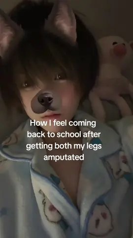 college essay is gonna be something serious lol #amputee #funny 