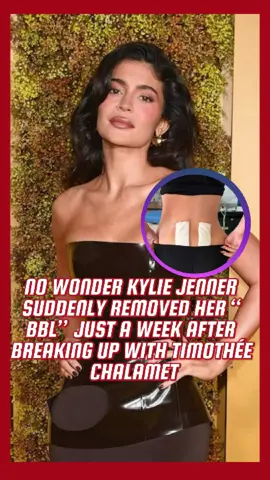 #tiktokstoriescontest No wonder Kylie Jenner suddenly removed her “BBL” just a week after breaking up with Timothée Chalamet—nobody realized that she had taken three bold actions to win him back, the last of which even jeopardized her career.#celebrity #tiktok #usa #foryou #usa #fyp #kyliejenner 