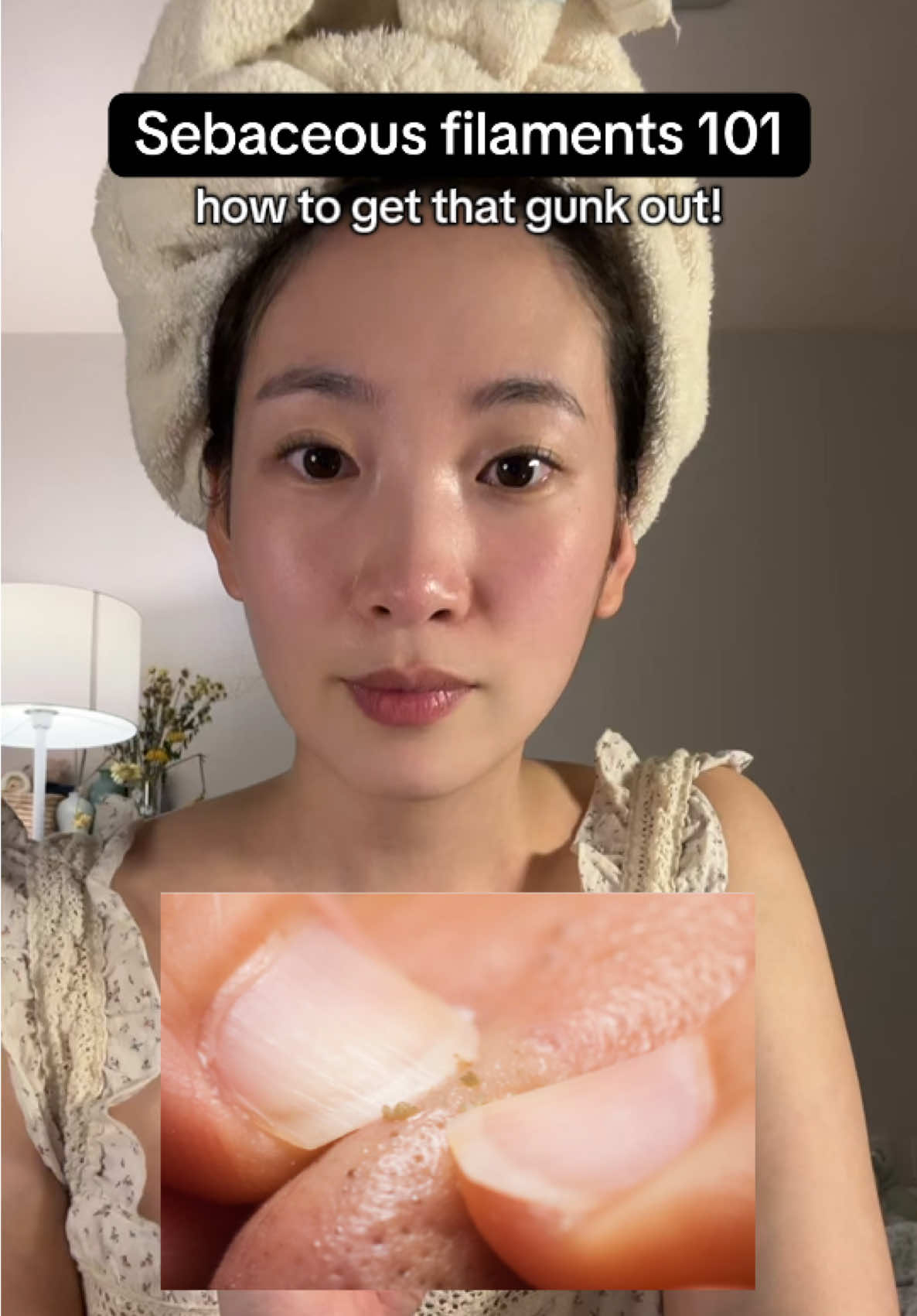 guysss this is an AD but when Skin1004 offered me paid ad I told them I wanted to make this video bc it is my go to products and routine ! This is why they said okay with me showing other brand products bc I insisted showing the whole process HONESTLY!!! 💛ty SKIN1004 for supporting me  Yess this works !! and thank you to @SKIN1004 US for my refills for next summer and an ad. 🫶 Love you  #whitehead #sebaceousfilament #skincare #skin1004 