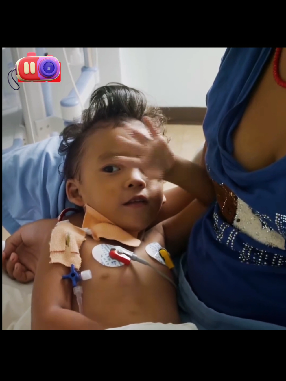 Born with an extra arm and fighting the risks of his story on body bizarre shows true strength  #bodybizarre #rarecondition #inspiration #staystrong #viralstory 