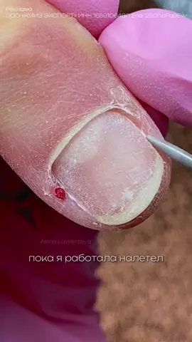 Проблема не в фрезе, а мастере 🤫 Даже качественная фреза с натуральным алмазным напылением может нанести вред, если использована неверно 😬 Пример на видео: если не отрезать заусенец, а зашлифовать его, получится вот такое дтп, еще все усугубила — работа на высоких оборотах… Фреза пламя с красным пояском самая ходовая и популярная фреза среди мастеров, кстати, на сайте КМИЗ есть много ее вариаций С умом подходите к выбору фрез под конкретные задачи в работе ❤️ #алёналаврентьева #маникюр 