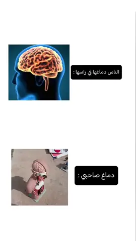 دمـاغ صاحـبي 🧠🤣... #صاحبي #الشعب_الصيني_ماله_حل😂😂 #دماغ #ميمز #اعادة_النشر🔃 
