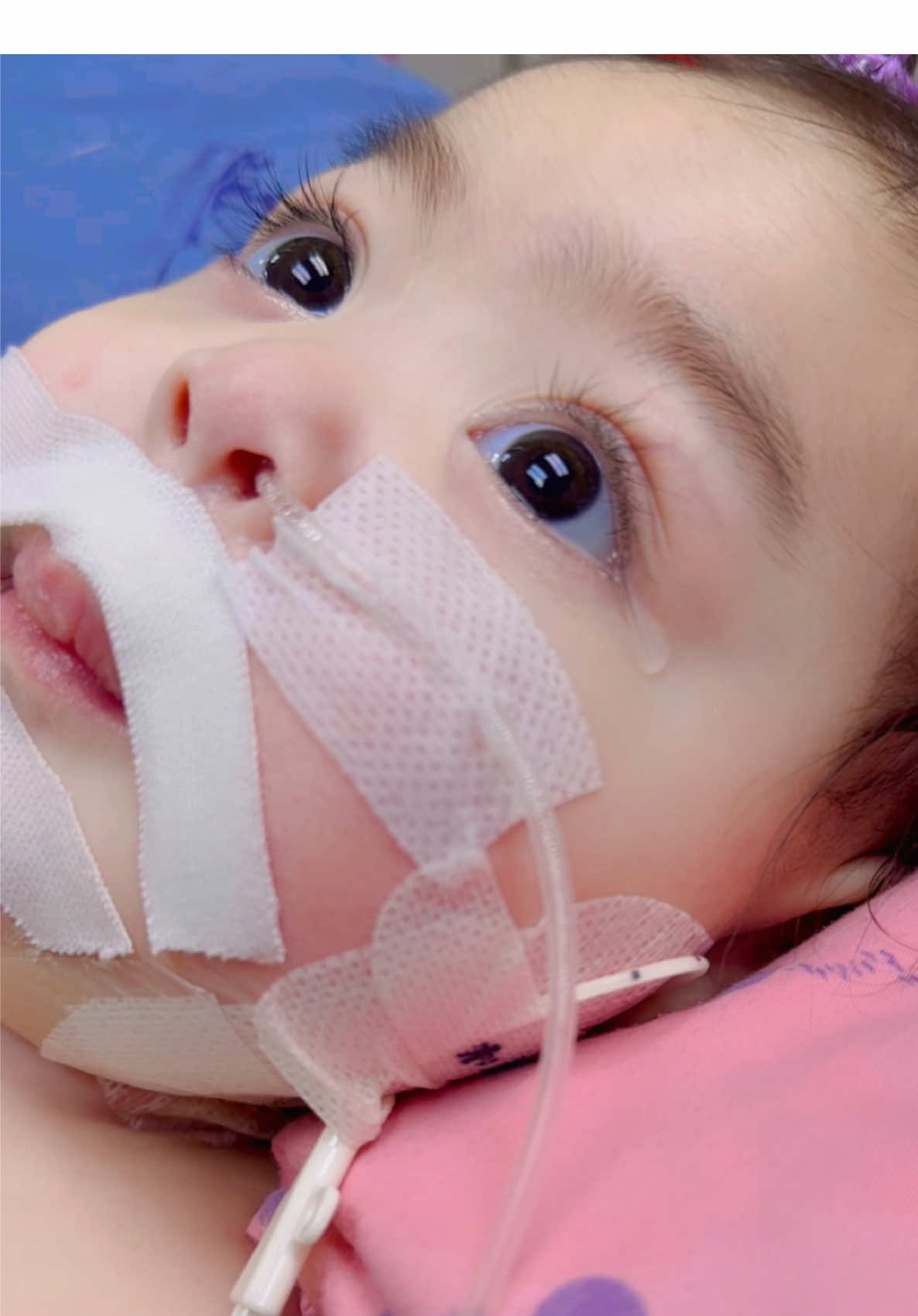 เจอกันแล้วเย้ๆๆๆ<<333  🫂🩵  ไม่เจอกัน2-3 วัน ดีใจร้องไห้ใส่เลออ กอดๆนะครับคนเก่ง  อาการทุกอย่างคงที่ไปในทางที่ดีขึ้น แล้วก็มีติดเชื้อเพิ่มตรงที่เจาะเส้นเลือดที่คอ ให้ยาฆ่าเชื้อเหมือนเดิม รีบหายนะครับก่อนวันเดินทางวันที่17 เราจะได้เลื่อนขั้นต่อไปในการรักษา  แค่นี้ก็เก่งที่สุดแล้วนะลูกบ่าวมะม๊า  สู้ต่อนะครับ 💪🏻✌🏻 #กล้ามเนื้ออ่อนแรง #smatype1 #ICU2เดือน11วัน 