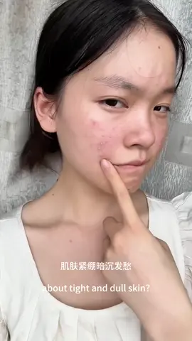 Tight/dull skin after cleansing? Milk+Amino Acid+Niacinamide Cleanser: FDA-certified brightening!#beauty #cleaning 