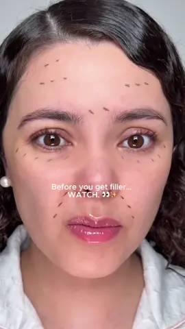 Before you book filler… WATCH THIS. 💉😳👇 No needle. No pain. Just glow. ✨ Save this before you forget.👇 #skincare #antiaging #pdrn #dralthea #skincaretok @Dr.Althea US 