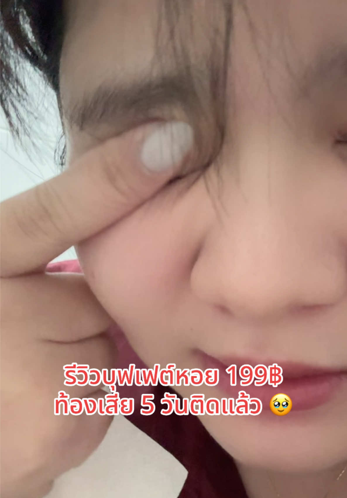 กินยาแก้ท้องเสียไปแล้วนะ แต่ไม่หาย 🥹