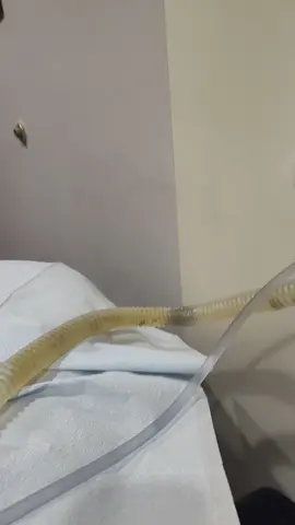 i didn't chew my salad thoroughly yesterday. don't be like me 😂😔#colonicsession #digestivehealth #colonhydrotherapy #colonicirrigation #coloncleanse @Well of Life Center 