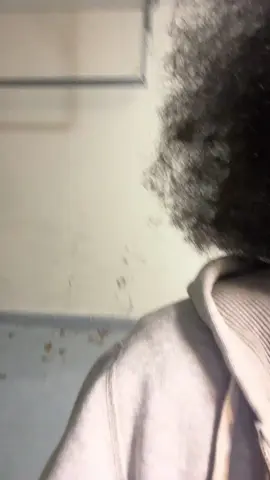 Skin out yuh tight tight #fyp #jamaican #atl #nyc #jamaicantiktok🇯🇲viral 