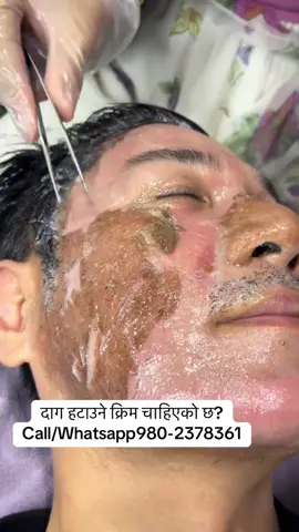 #foryou #muser #viralvideo #tiktokindia #scar 