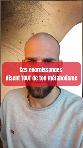 On les voit comme de simples bouts de peau inoffensifs. Mais les acrochordons (ou skin tags) sont souvent bien plus qu’un détail esthétique : 👉 ce sont parfois les premiers signaux d’un dérèglement métabolique que ton corps essaye de te montrer. Ton organisme envoie des alertes bien avant que tes analyses ne bougent. Alors si tu remarques ces petites excroissances autour du cou, des aisselles ou de l’aine… ne les ignore pas. Regarde la vidéo jusqu’au bout : tu vas comprendre pourquoi elles apparaissent et ce qu’elles révèlent vraiment sur ton insuline. Tu cherches une solution naturelle, va jeter un œil au bilan métabolique dans la bio 😉 #hormones #skintags #pertedegras #peau #bienetre 