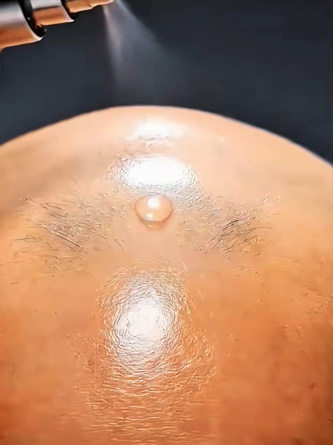 Haarausfall vorbeugen und Haarwachstum anregen#natürlicheschönheit #gesundheit #Hübsch #Tipps #geschichte #fyp