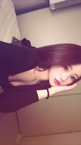 이제 곧 수술한지 한달차!!!!!!! #07 #fyp 