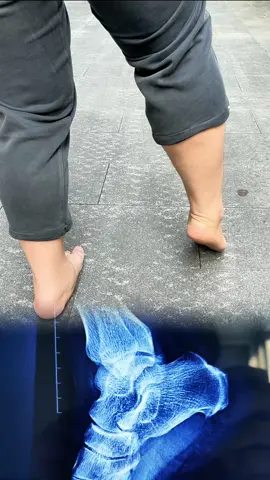 #painrelief#jointpain#arthritisrelief#inflammationrelief#tiktokmademebuyit 