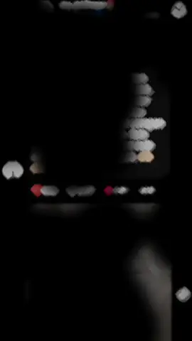 cepet sembuh sayang 🥹🫶 semua menunggumu🫂 #ฟรีฟาย #freenbecky #beckyarmstrong #srchafreen #moots? 