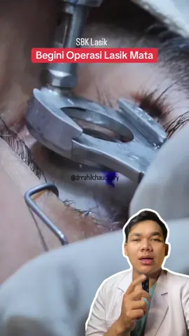 Orang mata minus/plus/silinder itu kayak kamera yang fokusnya salah, gambarnya blur. Selama ini kamu benerin fokus pakai kacamata kann Nah LASIK itu ibaratnya ngatur ulang fokus langsung di lensa alami mata, jadi nggak perlu kacamata lagi. Yang dioperasi adalah bagian transparan paling depan mata namanya kornea (kayak kaca kamera). Kornea ini yang menentukan arah masuknya cahaya. Lasik intinya adalah kornea kamu dibentuk ulang biar fokus cahaya jatuh tepat di retina. Ibarat tukang poles kaca kamera biar sudut lensanya pas. Rasanya gimana? Biasanya nggak sakit karena ditetes anestesi lokal. Cepet banget, 10an per mata. Lasik ini cocok buat temen2 yang punya mata plus, minus, maupun silinder. Ada yang dah pernah coba??