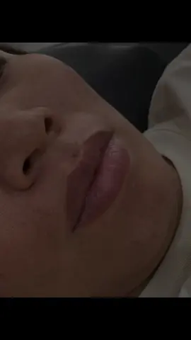 Khử thâm môi đi mấy bà             Chân ái lắm á nha #CapCut #khuthammoi #khuthammoitunhien #lamdep 