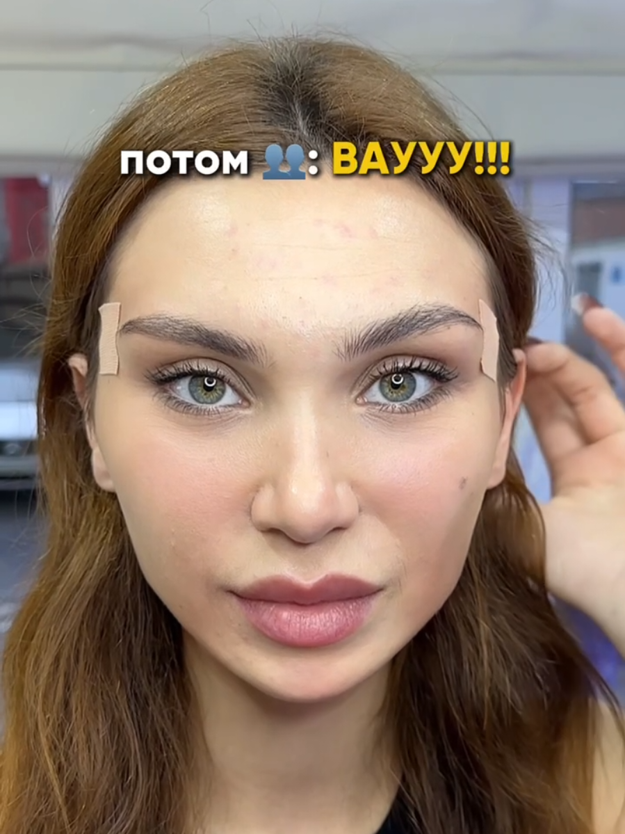 🌿FULL FACE - естественности🌿 Помогли преобразиться нашей пациентке🔥 Убрали уставший вид и проработали с качеством кожи😳 🧨Проводили процедуру full face для пациентки 🫶🏻Ваша реакция после процедуры говорит сама за себя  🫶🏻Мы стараемся выкладываться на максимум  Используем премиум препараты  И постоянно повышаем квалификацию🔥 Записывайся и получи скидку 👉😁#косметология#натуральнаякрасота#fullface