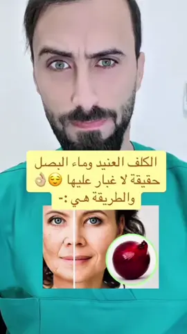 وصفة الكلف للي مابقدرو يشترو الخلطات والكريمات