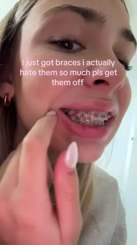 help me #braces #ortho #ihatethem #fyp 