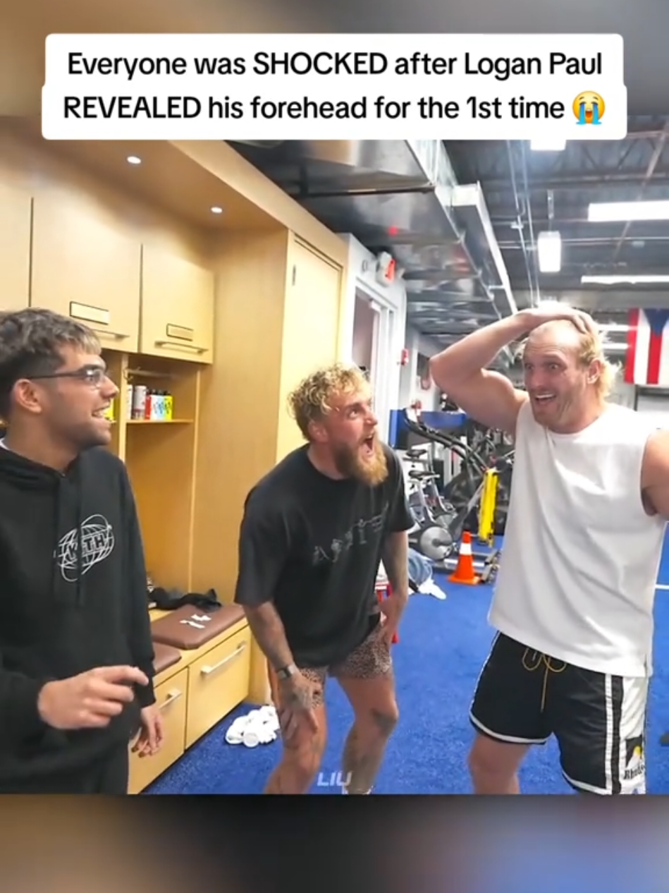 Everyone was SHOCKED after Logan Paul REVEALED his forehead for the 1st time 😭 #loganpaul #n3on 