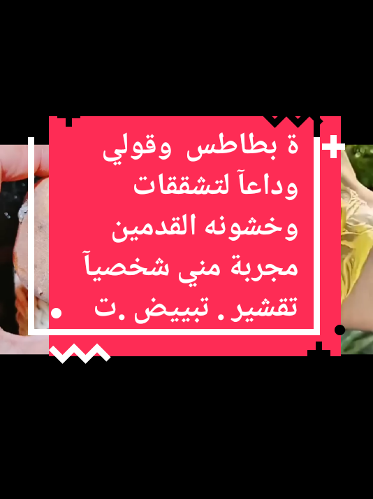 ة بطاطس  وقولي وداعآ لتشققات وخشونه القدمين مجربة مني شخصيآ تقشير . تبييض .تر#متابعة #الشعب_الصيني_ماله_حل😂😂 #اكسبلورexplore #اسبانيا🇪🇸_ايطاليا🇮🇹_البرتغال🇵🇹 #متابعيني_احبكم 