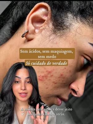 Sérum Facial Amazônico. 100% natural, com ativos da floresta e poder antioxidante. Confira!