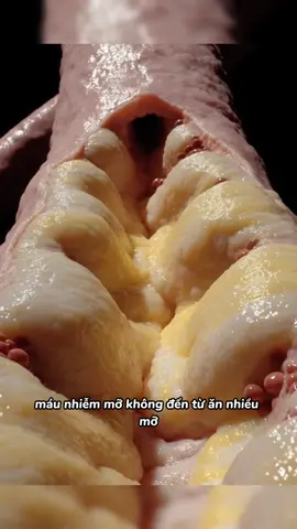 M.áu nhiễm mỡ #thinhhanhtiktok #LearnOnTikTok #xuhuong2025 