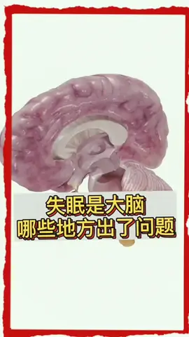 失眠是大腦那裡出了問題？ #我要上推薦 #我要上熱門 #養生 #失眠 #大腦