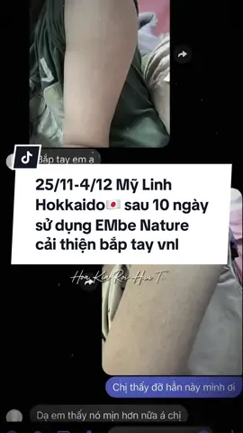Bé Mỹ Linh hokkaido 🇯🇵 tặng feedback cực chất sau 10 ngày sử dụng sữa tắm EMbe Nature cải thiện da cánh tay Viêm nang lông 🥰🇯🇵✨ #viemlochanlong #munbody #quynhanhembe #EMbenature #feedback 