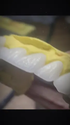 Đại đại luôn đi🫣🫣🫣#xuhuong #kỹthuật #răng_sứ_thẩm_mỹ #rangsuthammy 