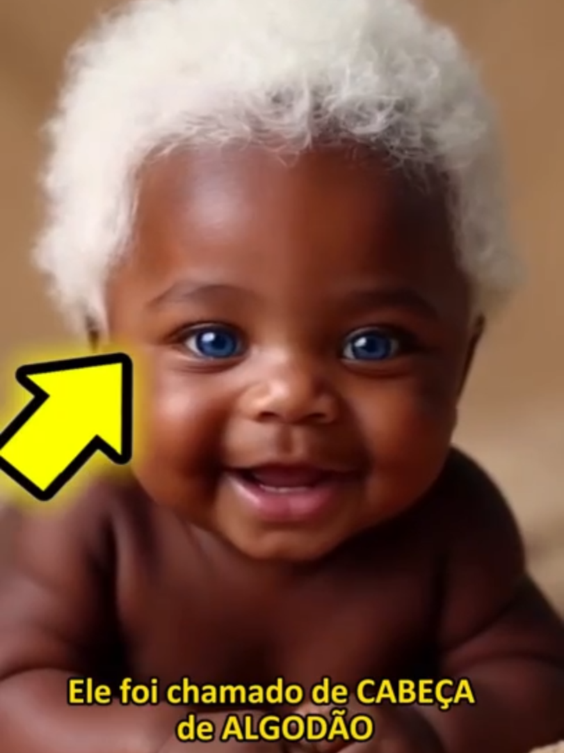 BEBÊ é chamado de CABEÇA de ALGODÃO, mas HOJE ele está...  #shorts #shortsviral #viral #curiosidades #MataCuriosidade #HistóriasTocantes #HistóriasInteressantes #históriasincríveis #incrível #fatosincriveis #históriasEmocionantes #baby #beautifulbaby #amazingbaby #cutebaby #babyeyes #differenteyes #blueeyes #heterochromia #uniqueeyes #incredibleeyes #rareeyes #olhosincríveis #olhodecadacor #olhosbonitos #olhosazuis #olhosraros #olhodegato #fenômenonatural #unbelievable #wow #amazing