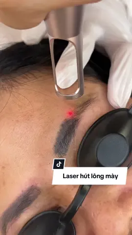 Tình trạng lông mày trổ xanh, đỏ ,đen đậm lệch dáng thì bắn laser là lựa chọn chân ái cho các chị em rồi đó nha🥰 #xoasualongmay#tiktok #viettri #phunxamthammy  #laser