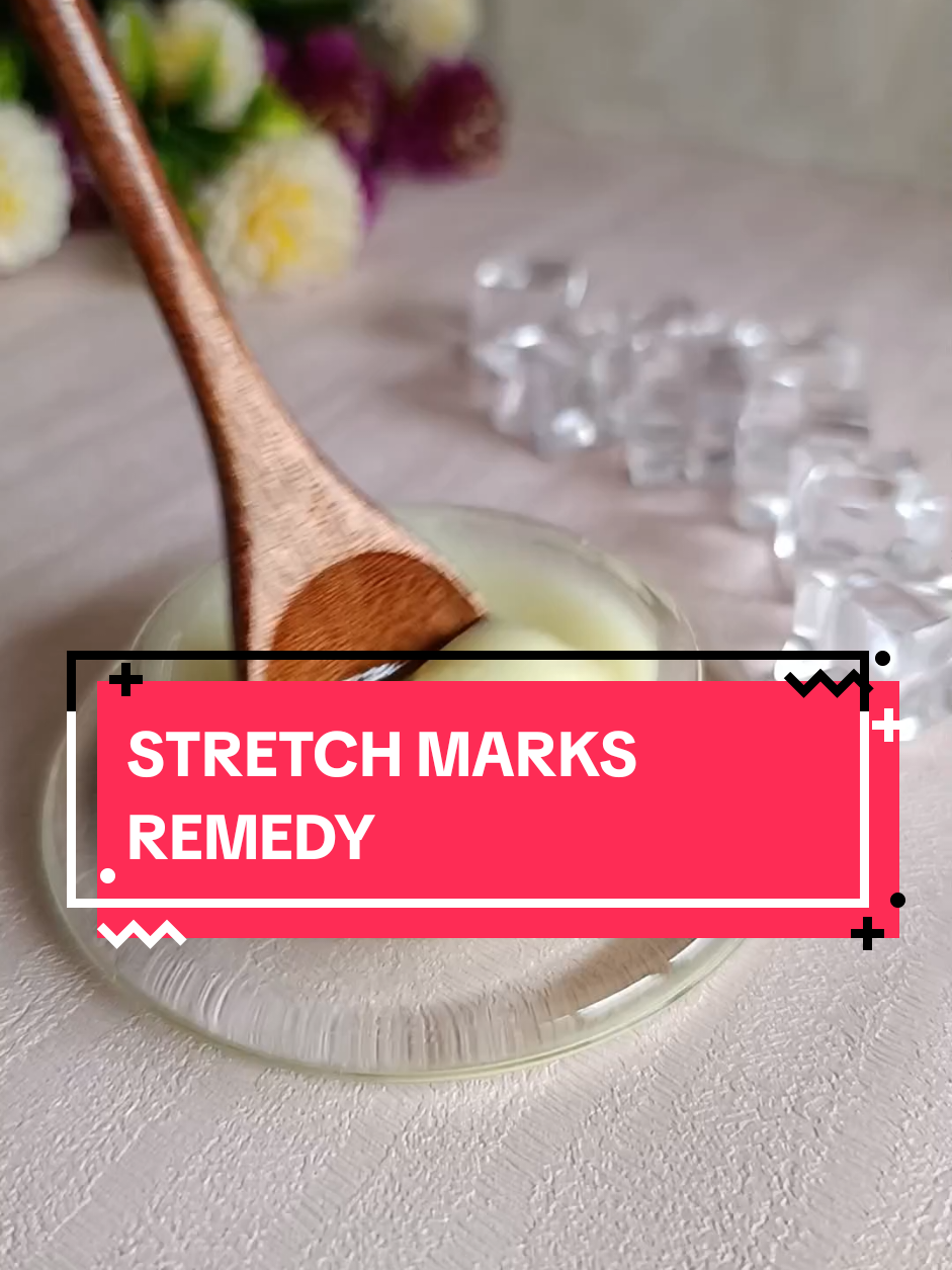How to treat stretch marks naturally. #stretchmarks #stretchmarksremedy #naturalremedy #naturalrecipe 
