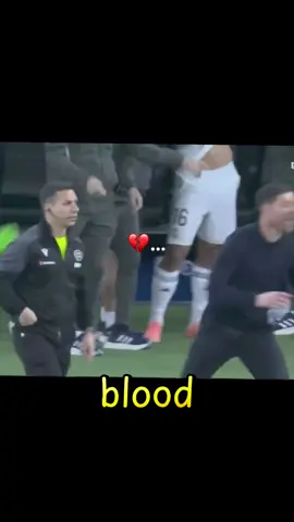 #realmadridfc #vs #celta #in #der Laliga bellingham Mbappe 💔