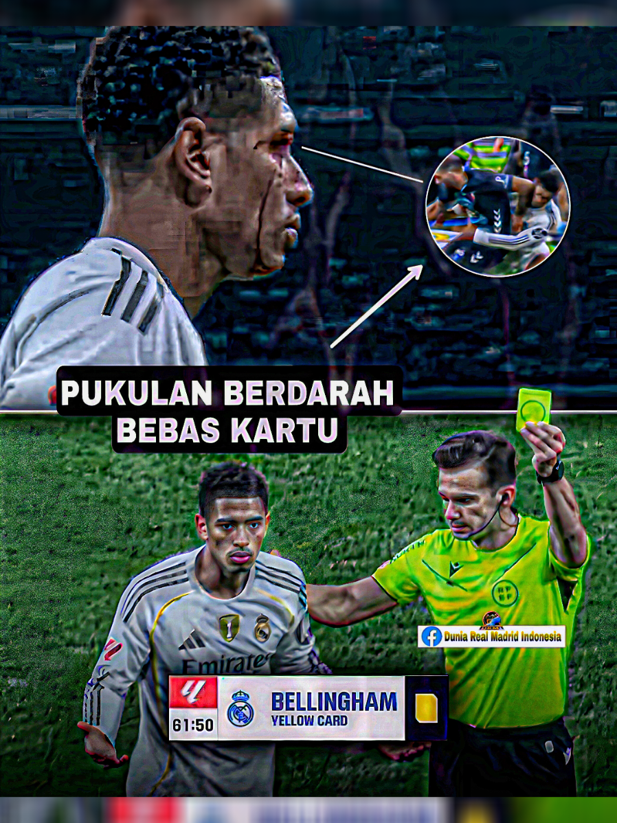 real madrid vs everybody 😷🤙🏻 #bellingham #sepakbola #xycba #fypシ 