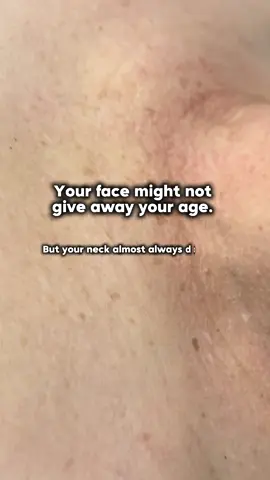 Why work so hard to perfect your face, only to have your neck give it all away? Keep your neck youthful and wrinkle free with PDRN skin booster 🧬✨ Contact us to learn more 📱 WhatsApp +65 8129 9789 📩 DM Facebook/Instagram