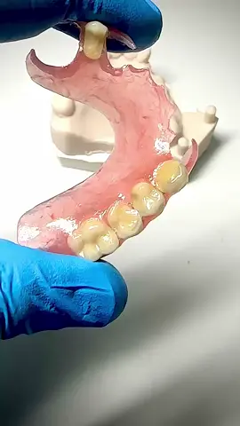 #gigiputih #gigipalsu #gigiflexible 