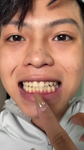 Răng ố vàng? Đừng lo! ⭐ Lysmilego tẩy sạch & trắng bền lâu – Không gây hại răng!#miengdantrangrang #lamdep #trangrang #chamsocrangmieng #rangdep #foryou #dealhot #trangrangtaitnha #rangtrangdep #xuhuong #trangrangcaptoc #rangtrangtuynhien #phunu