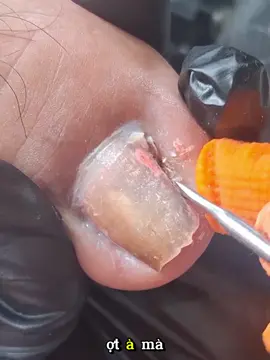 Lấy khoé siêu phê #laykhoe #laykhoemong #laykhoechan #laykhoemongchan #taovamich 