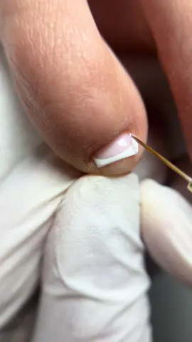 👶 French on little finger  #nails #pedicure #frenchnails #fy