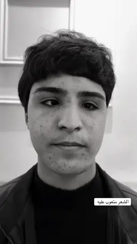 #الشعر متعوب عليه شعندك شعر شمره بله تعليقات 