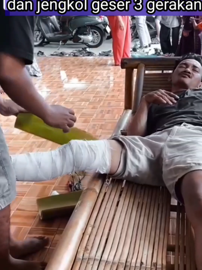 #patahtulang #pengobatanalternatif #follow 