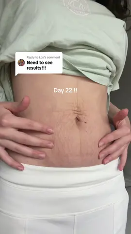 Replying to @Lcs FLASH SALE RN!!! #28daychallenge #postpartumbody #sunluxy #postpartumjourney #tiktokshopblackfriday