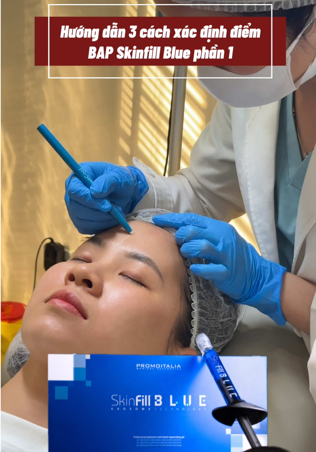 Hướng dẫn 3 cách xác định điểm BAP Skinfill blue. Phần 1 #skinartdebeaute #bacsyhuongnoi #skinartacademy #skinfill #skinfillblue 