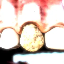 batalha de edit contra @𝖆𝖘𝖆𝖕𝖍 ᴱᴿᴿᴼᴿ | Sukuna edit | tags: #edit #nodevideo #Capcut #foryourpages #fypシ゚ 