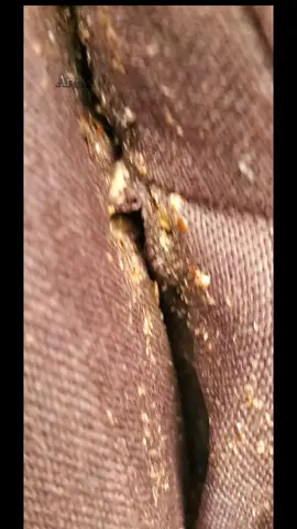 Are you really entering 2026 with bedbugs still living in your space? 😭 #bedbuginfestation  #bedbugs #Bedbugs  #bedbugstreatment  #bedbugspray  #creatorsearchinsights  #fumigationservices  #fumigationinlagos  #cleaningservice #crowncare11 